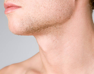 Neck Lift for Men Los Angeles