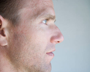 Rhinoplasty for Men Los Angeles